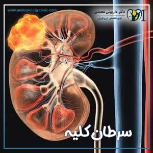 سرطان کلیه + دکتر داریوش محمدی