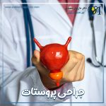 جراحی پروستات - دکتر داریوش محمدی