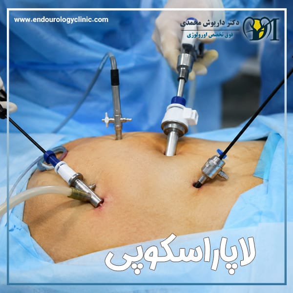 لاپاراسکوپی در تهران | دکتر داریوش محمدی