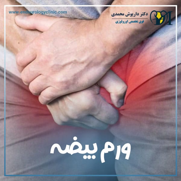 ورم بیضه + دکتر داریوش محمدی