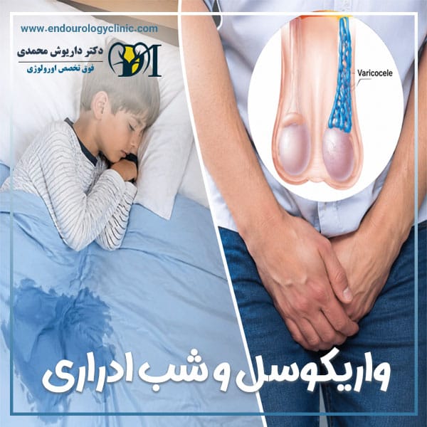 واریکوسل و شب ادراری + دکتر داریوش محمدی