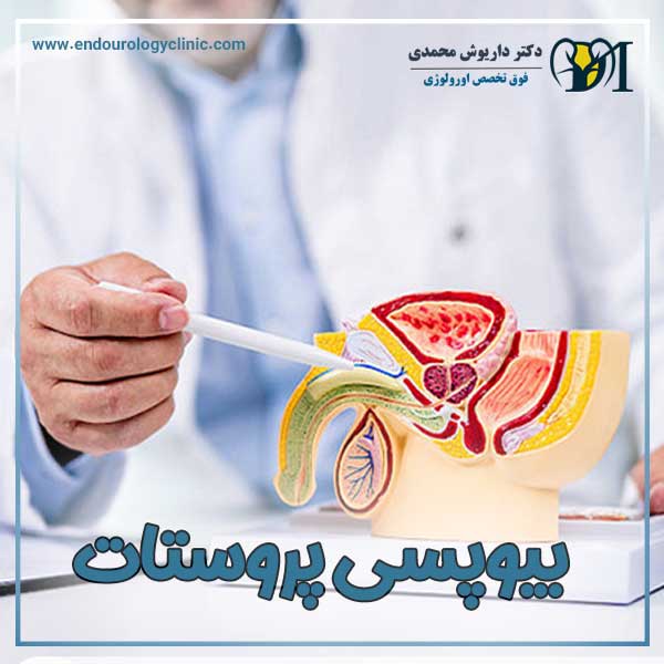 بیوپسی پروستات + دکتر داریوش محمدی