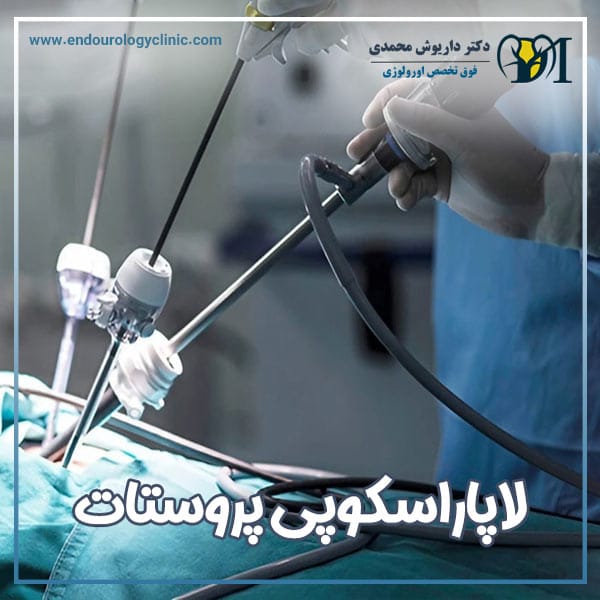 لاپاراسکوپی پروستات + دکتر داریوش محمدی