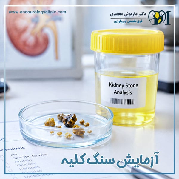 آزمایش سنگ کلیه + دکتر داریوش محمدی